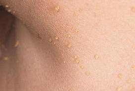 Pori di restringendo di crema per il viso